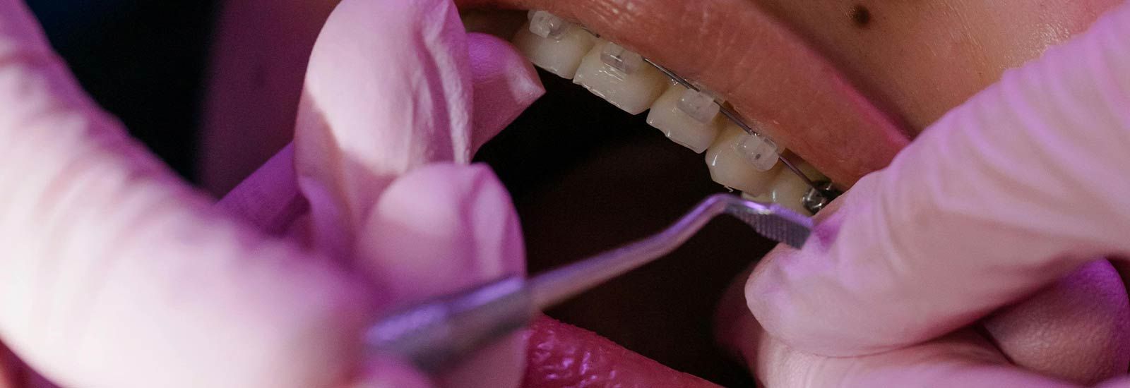 Ortodoncia en Santander