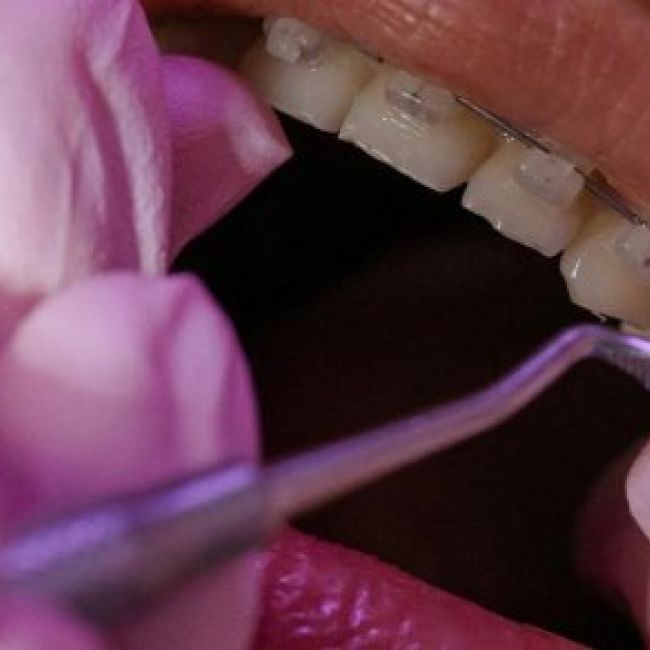 Ortodoncia en Santander